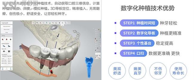 北京科爾口腔種植牙技術(shù)