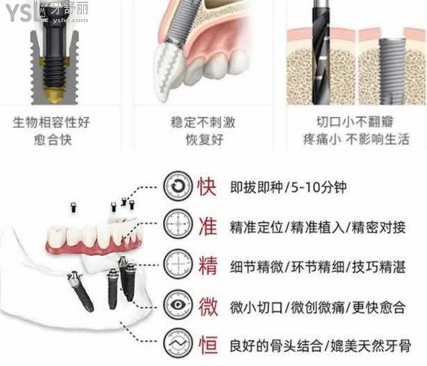重慶種植牙哪家醫(yī)院比較好