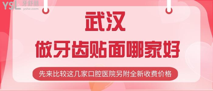 武漢做牙齒貼面哪家好？先來比較這幾家口腔醫(yī)院另附全新收費(fèi)價(jià)格