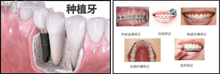 想去鞍山種植牙和矯正牙齒都比較好的口腔就來這里吧，都是本地牙科診所排名中靠前的口碑牙科