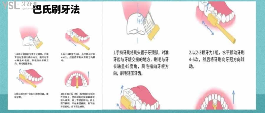 牙齦萎縮圖片及癥狀怎么治療