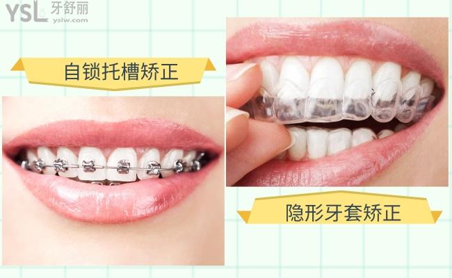 矯正器