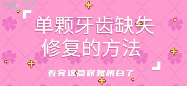 單顆牙齒缺失修復(fù)的方法，看完這篇你就明白了