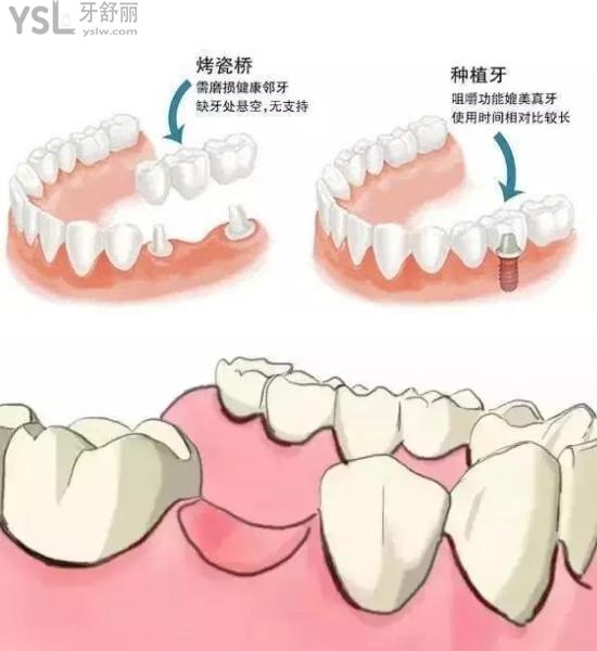 牙齒缺失