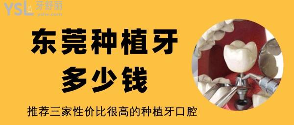 東莞種植牙多少錢 東莞性價比高的口腔