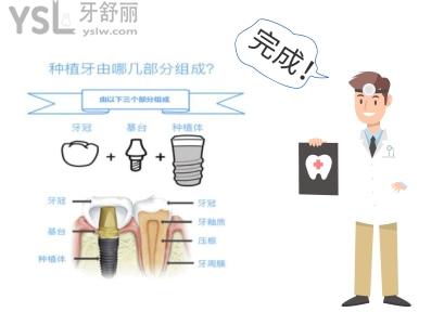 種植牙遭罪嗎 真正的種牙手術(shù)是什么感覺