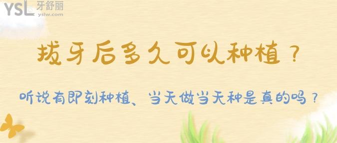 拔牙后多久可以種植？聽說有即刻種植、當天做當天種是真的嗎？