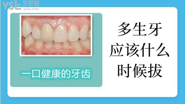 多生牙什么時候拔掉