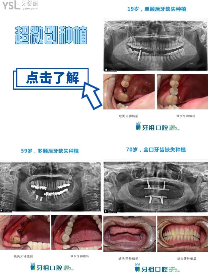 長(zhǎng)沙口腔醫(yī)院哪家好