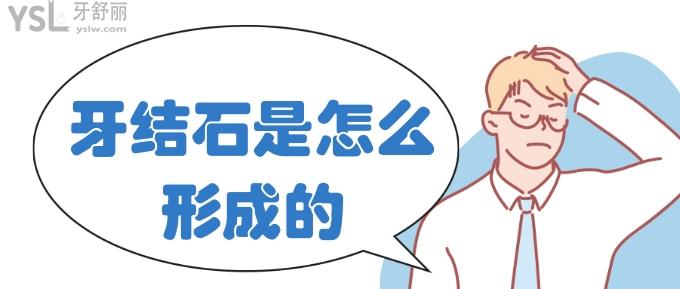牙結石是怎么形成的