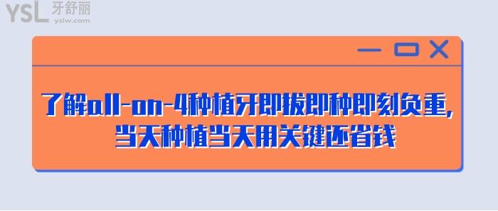allon4即拔即種即刻負重