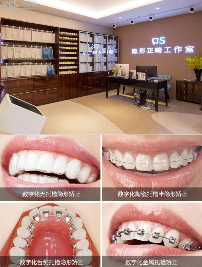 北京勁松口腔醫(yī)院有半隱形矯正嗎？做的怎么樣大概多少錢？