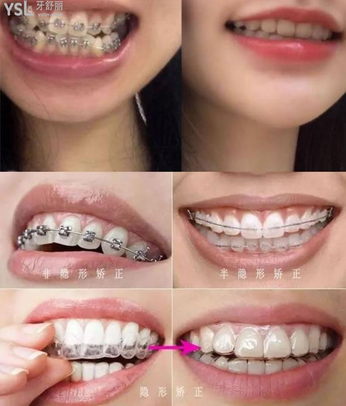 濱州各口腔醫(yī)院整牙價格表