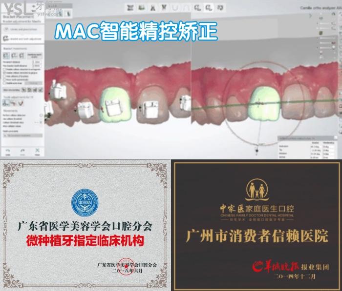 廣州中家醫(yī)家庭醫(yī)生口腔做隱型矯正嗎？多少錢？哪個醫(yī)生好？
