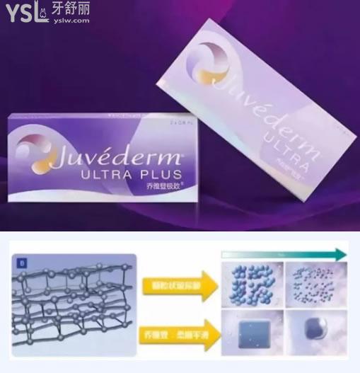 喬雅登玻尿酸