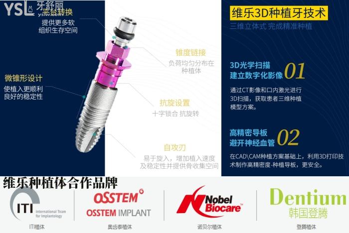 get新福州種植牙醫(yī)院排名！沒有BBQ只有哪家牙科醫(yī)院種植比較好！