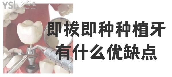 即拔即種種植牙優(yōu)缺點(diǎn)