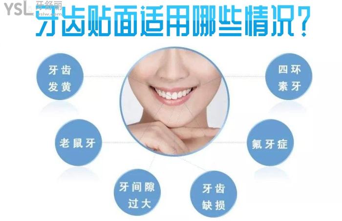 千萬別做牙齒貼面！去過贛州韓美口腔整牙親歷告訴你！