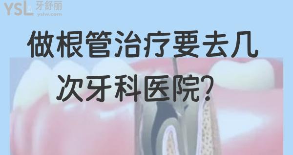 根管治療一般做幾次