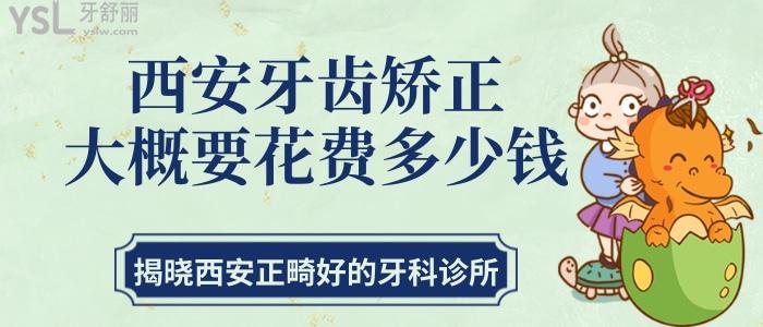 西安牙齒矯正大概要花費(fèi)多少錢(qián) 揭曉西安正畸好的牙科診所