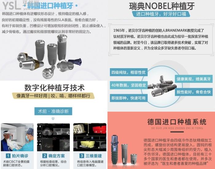 重慶團圓口腔種植牙價格公布！親民價還好用！附收費價格表！