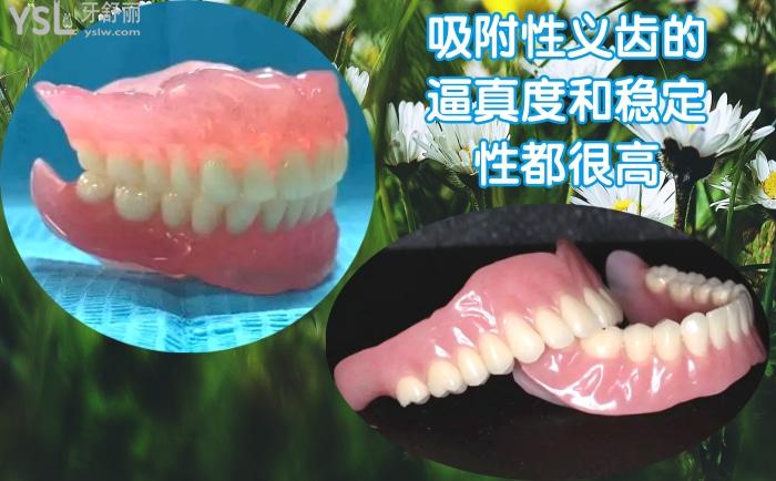 bps全口吸附性義齒價(jià)格多少錢？與普通活動(dòng)義齒的區(qū)別大嗎？