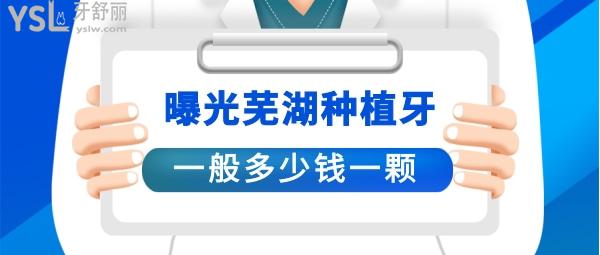 蕪湖種植牙一顆大概多少錢