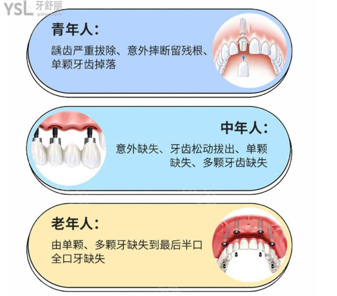 想知道在?？诜N全口牙需要多少錢？看完這份?？谘揽剖召M價目表輕松了解！