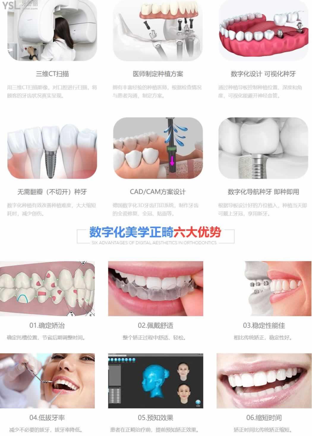 桂林藍(lán)天牙科收費(fèi)高嗎