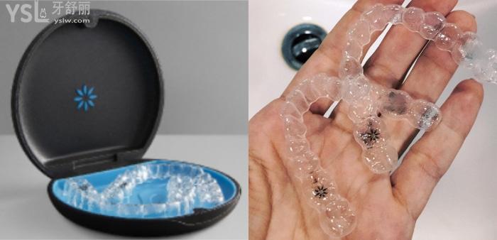 珠海隱形牙套哪家醫(yī)院比較好?推薦暨博口腔技術好價不高!