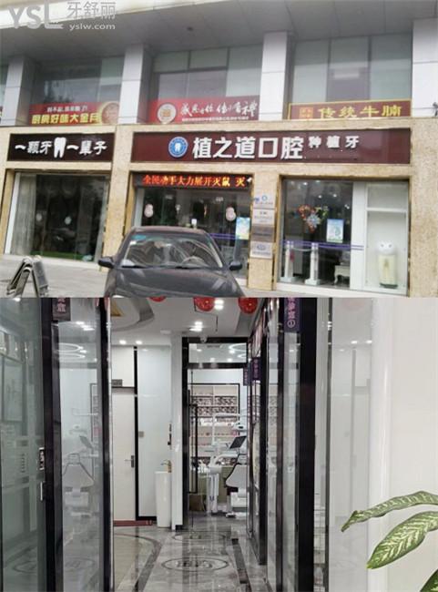 ?？谥仓揽谇环N牙怎么樣