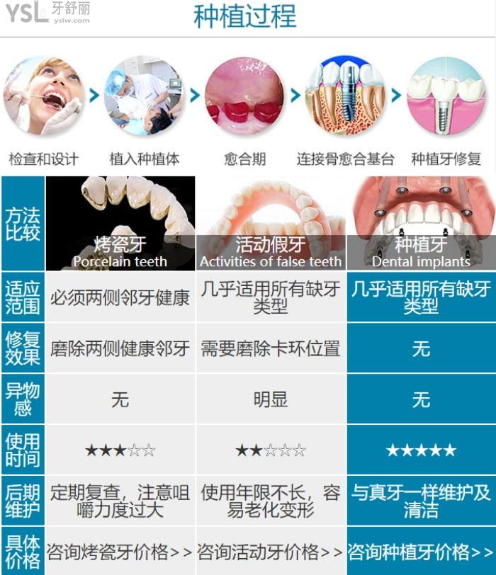 沈陽康貝佳口腔醫(yī)院地址在哪里？種植牙多少錢一顆貴不貴？