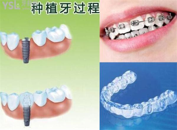 江門口腔醫(yī)院價(jià)格表