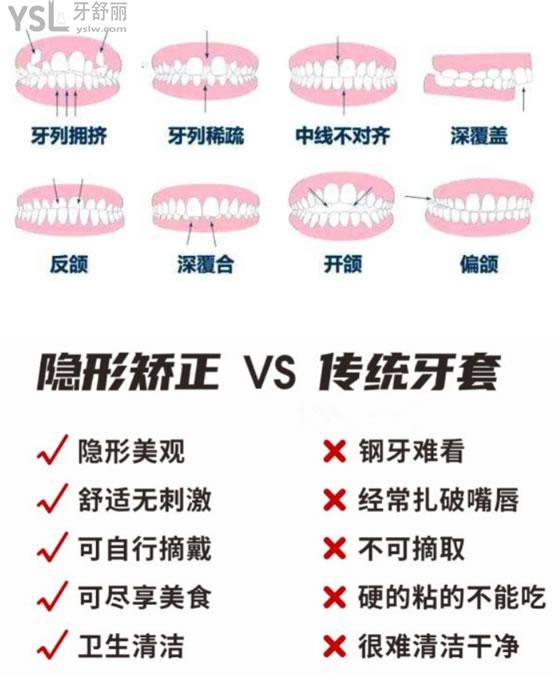 牙齒矯正