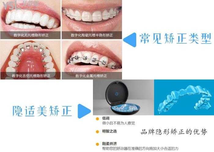 廣州好大夫口腔隱適美矯正怎么樣？技術(shù)靠譜性價(jià)比高就找好大夫！
