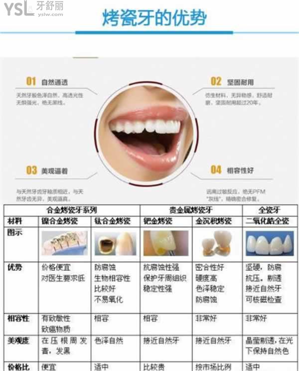 北京各口腔醫(yī)院鑲牙價(jià)格表，做烤/全瓷牙冠多少錢一顆