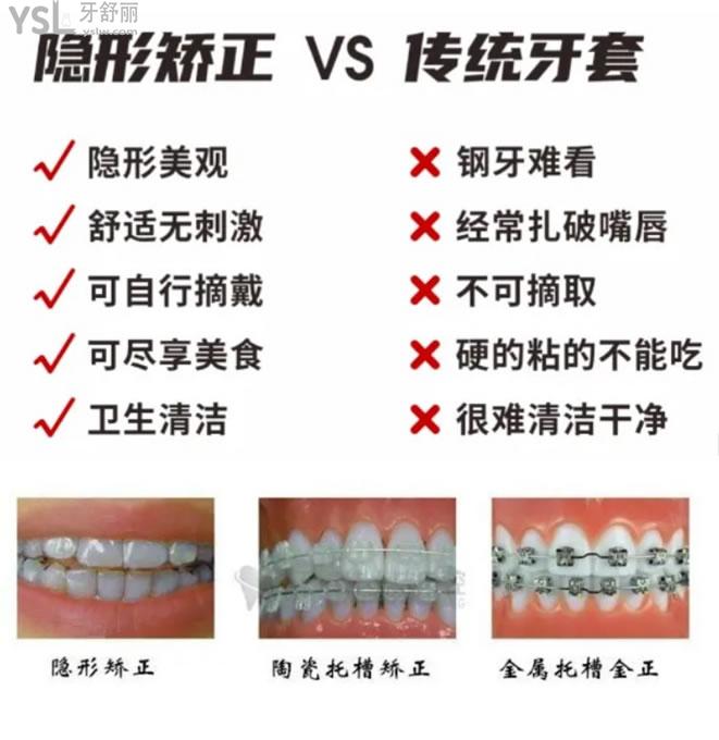 牙齒矯正圖