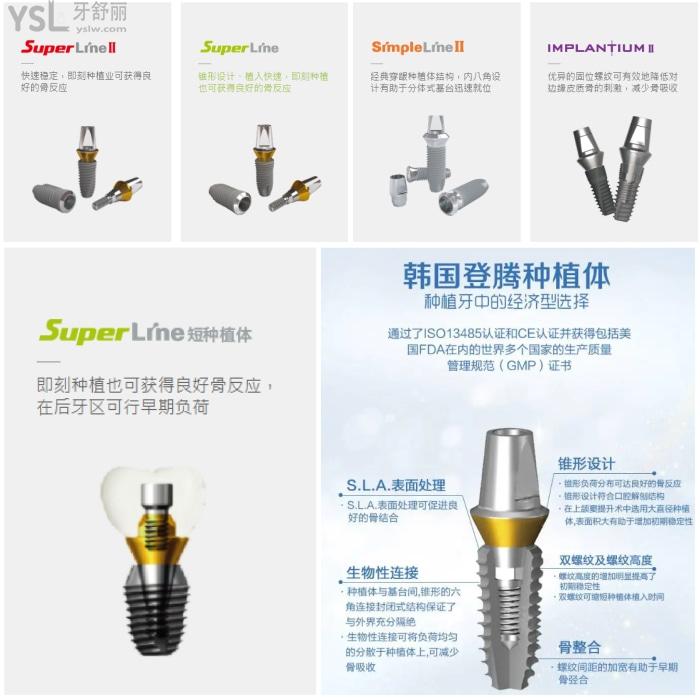 韓系種植牙種植體質(zhì)量如何？使用壽命和價錢多少？