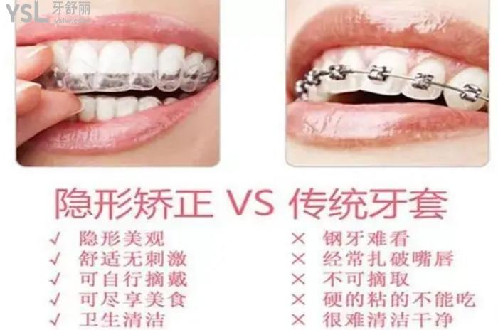隱形矯正和金屬矯正哪個好？看好兩者區(qū)別做矯正事半功倍！