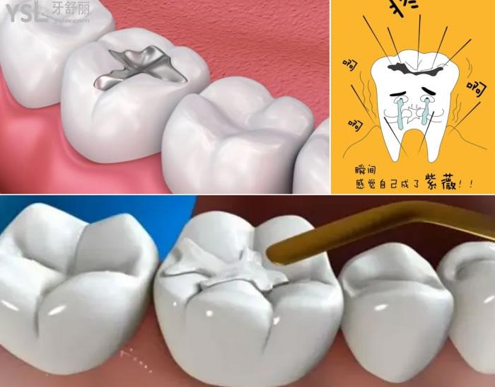 福清哪里補(bǔ)牙比較好.jpg