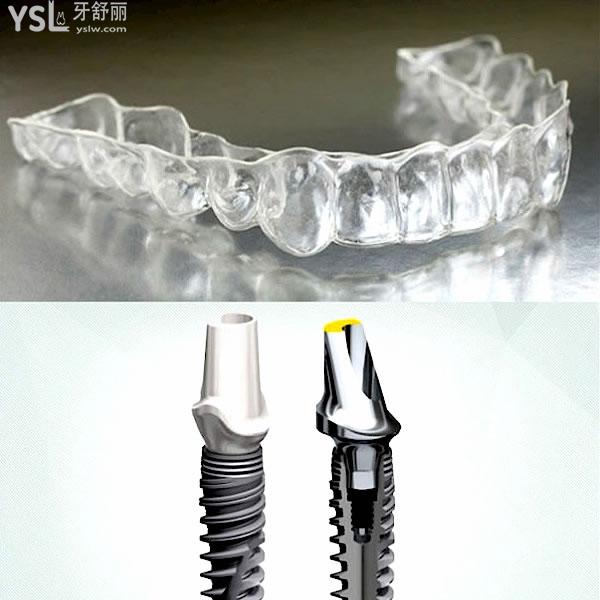 六安土豆口腔醫(yī)院收費標準更新至2022年!種植牙/牙齒矯正價目表口碑好不亂收費