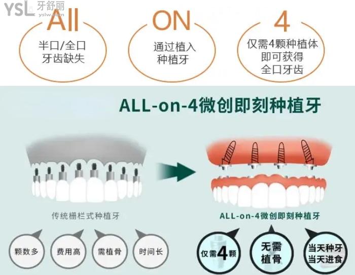 廣州種植牙哪個(gè)醫(yī)院做的好?這些有名的種植牙醫(yī)生價(jià)格公道口碑好不可錯(cuò)過!