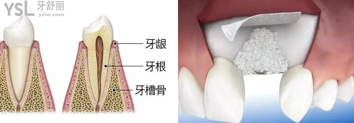 種植牙用的骨粉價格.jpg