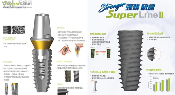 韓國(guó)登騰種植牙3900元一顆含基臺(tái)嗎？質(zhì)量怎么樣？是什么材質(zhì)？