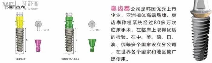 奧齒泰種植體型號(hào)大全