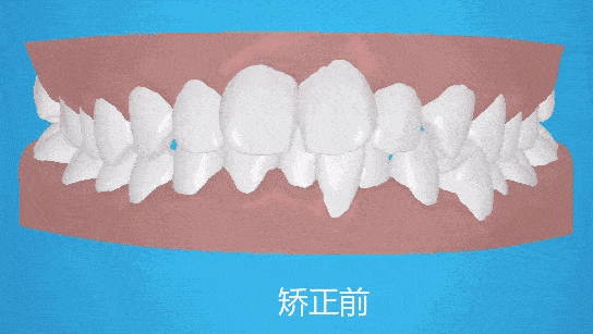 牙齒矯正廣州哪家牙醫(yī)院好呢？推薦廣州正畸醫(yī)生康祖銘、王釗偉、李錦鴻等實(shí)力派！