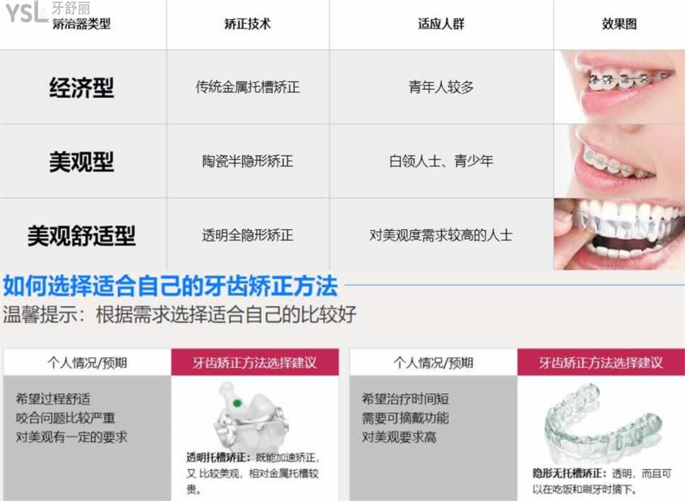 合肥牙齒矯正醫(yī)院排名