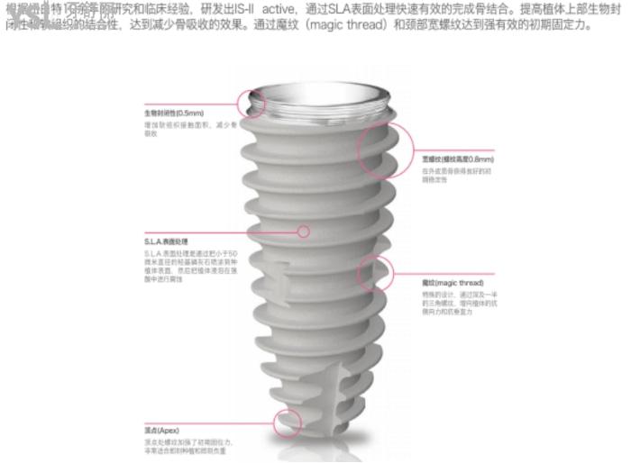 紐百特種植牙怎么樣？和登騰比哪個好？檔次及價(jià)格如何？