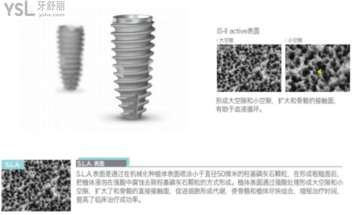 紐百特種植牙怎么樣？和登騰比哪個好？檔次及價(jià)格如何？