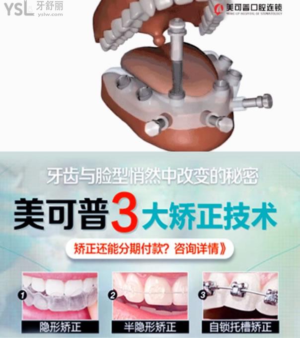 福州美可普口腔醫(yī)院牙齒矯正和種植牙技術(shù)優(yōu)勢
